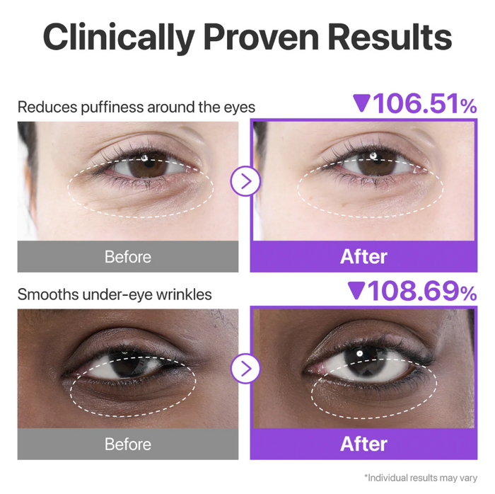 No.9 NAD+ Collagen Under Eye Patches - Kolagenowe Płatki Pod Oczy 